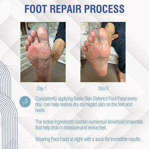 Basix Skin Defence Foot Food - For Dry Feet & Cracked Heels - 50ml